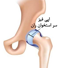Image result for ‫مشکلات مفصل ران‬‎
